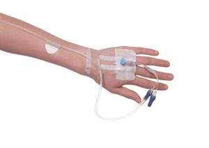 A new and pain-free way to secure IV tubing