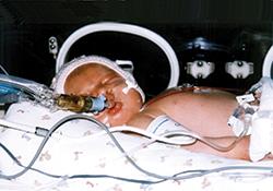 Group B Strep tests for pregnant women