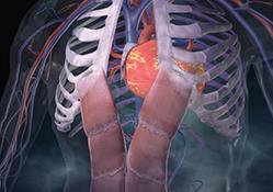 NICE quality standard aims to reduce CVD risk