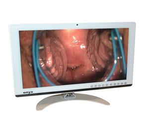 Global launch for gynaecological workstation