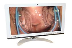 Technology boost for cervical screening in Wales 