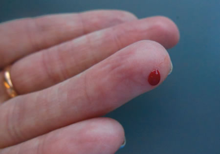 Calls to improve diabetes care