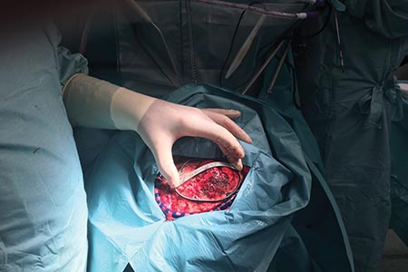 3D printing opportunities for medical technology
