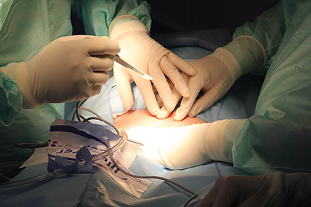 Surgicalrobotics: alook into the future