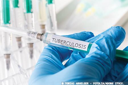 Tackling the threat of tuberculosis 