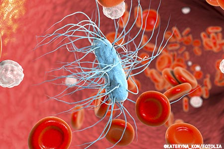 NICE: Treat sepsis within an hour