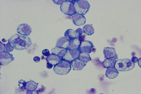 Major breakthrough in the manufacture of red blood cells