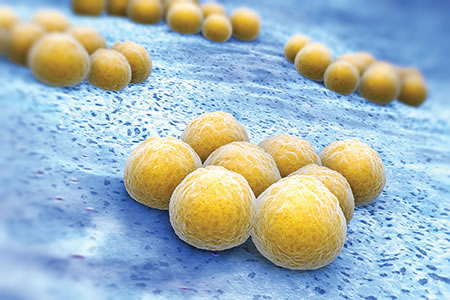Addressing the issue of anti microbial resistance