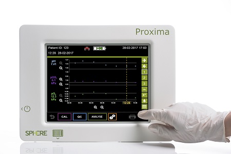 Sphere Medical introduces Trend Graphs and Scheduling 