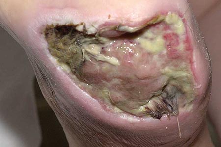 Assessing and healing wounds