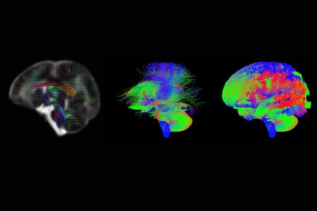 Newborn baby brain scans will help scientists track brain development