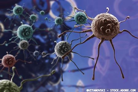 Striving to conquer lung cancer