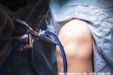 Improving surgical quality measures