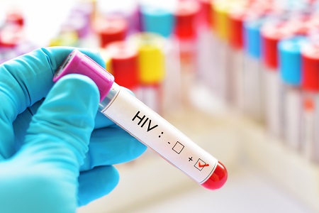 Cardiff implements new technology to drive excellence in HIV care
