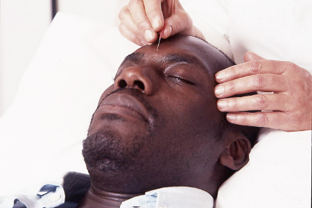 New NICE guidance should include acupuncture, says membership body