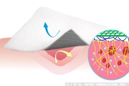 Bandage material helps stop bleeding without adhering to the wound