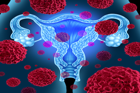 Roll-out of new cervical screening test will save more lives