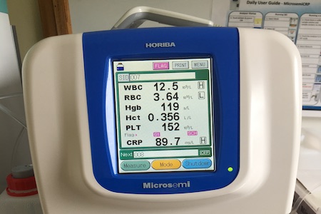 POC analysis helps keep vulnerable patients safer in Cornwall