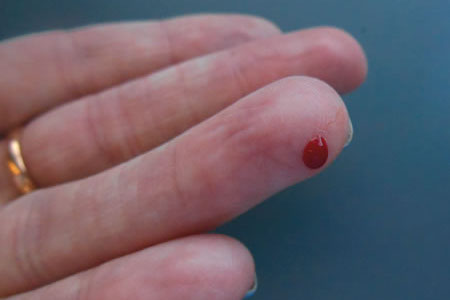 Surge in people checking their risk of type 2 diabetes