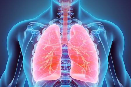First UK patient support group for people with NTM lung disease