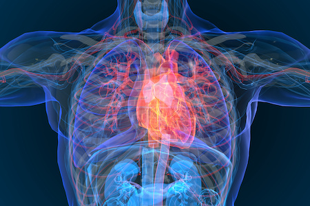 Cancer patients not receiving life-saving heart attack treatment  