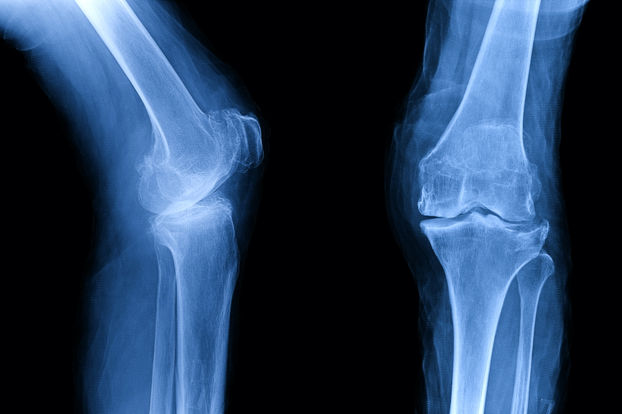 Clinically-led changes result in annual savings of £450,000 