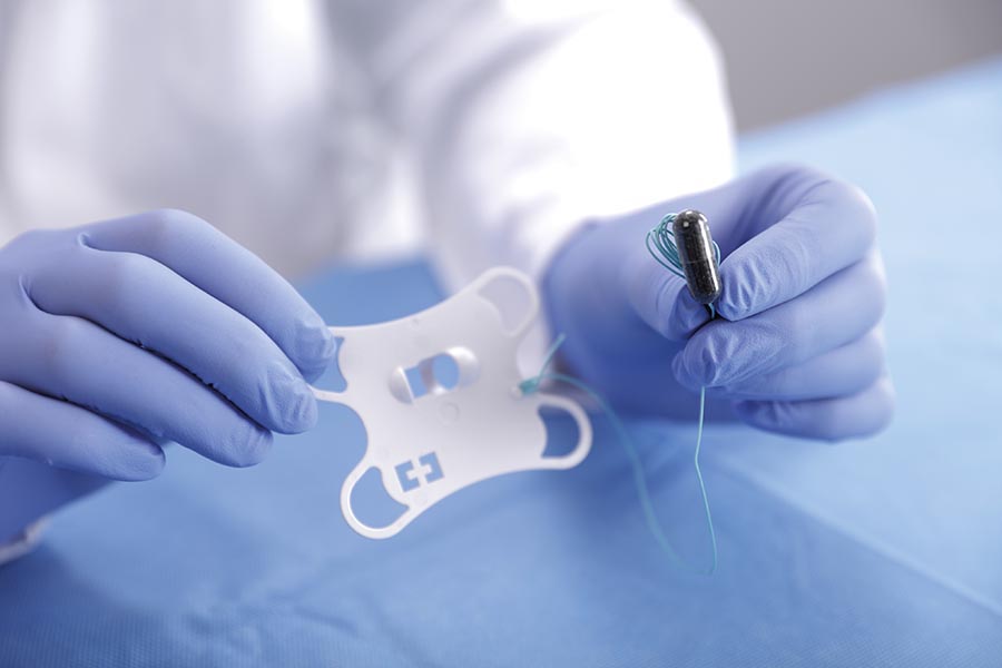 Sponge device to ease endoscopy waiting lists