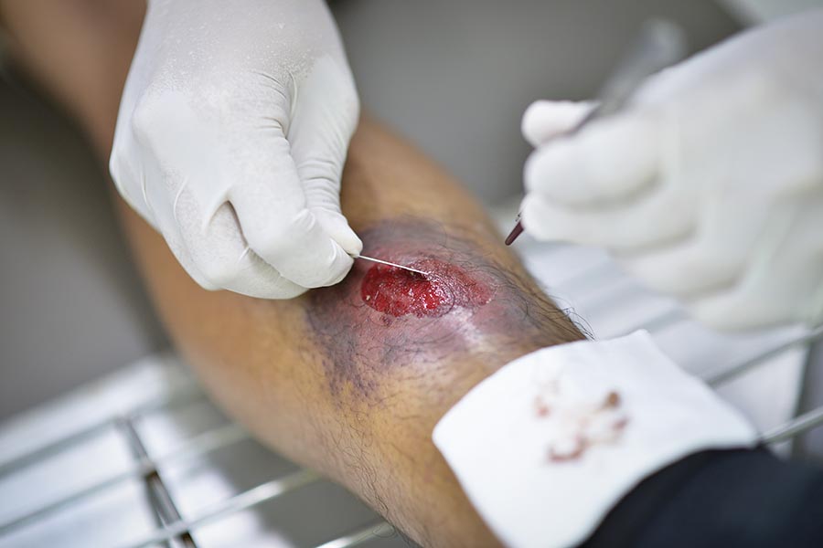 Advances in wound care management
