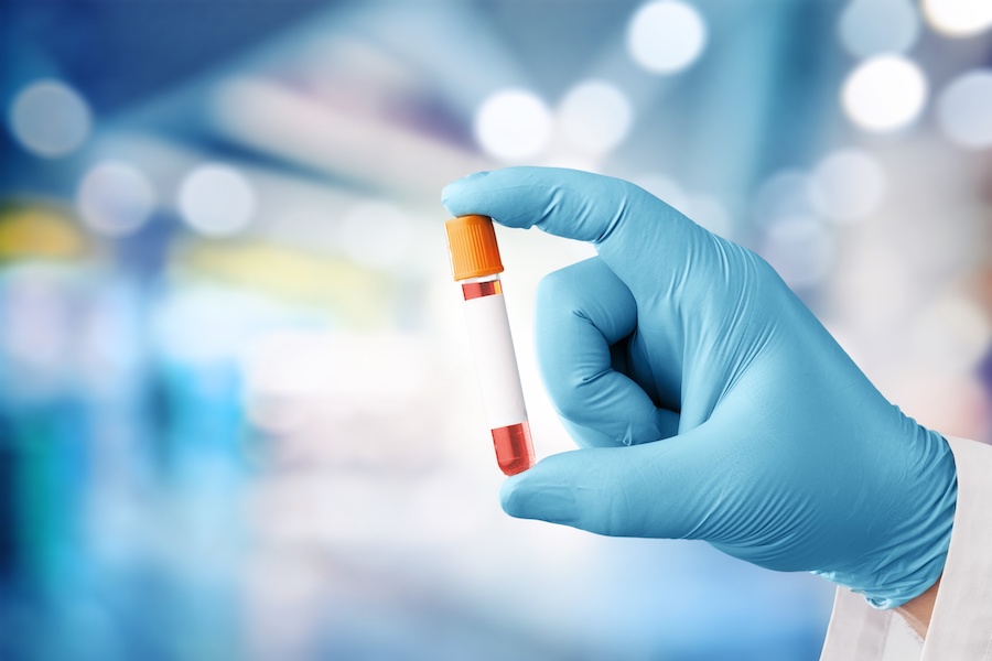 Barts Health and Sectra start digital pathology programme 