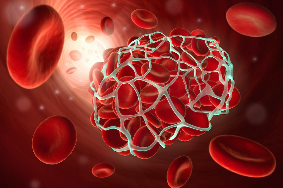 Study: TV watching linked with potentially fatal blood clots