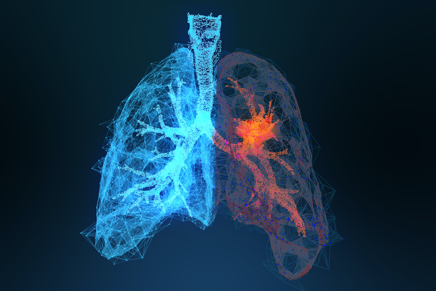 NHS backs ‘pioneering’ new cancer innovations 
