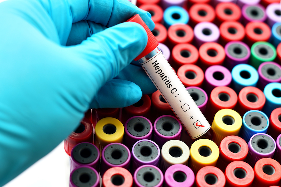 Reduction in deaths from hepatitis C 