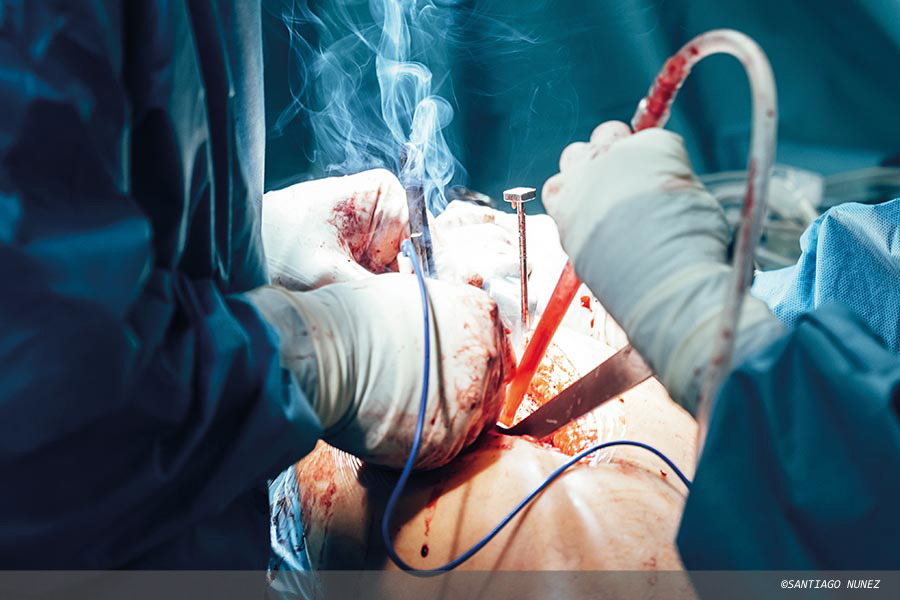 Surgical smoke inhalation: staff fear infection risk