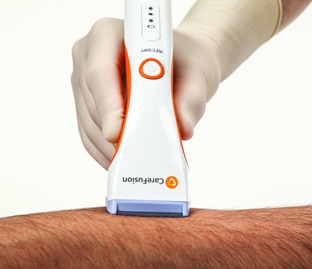 Ergonomically designed surgical clippers