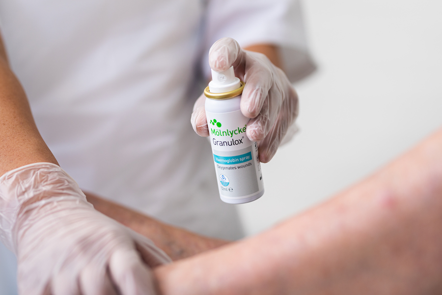 NICE issues guideline on oxygen therapy for wounds