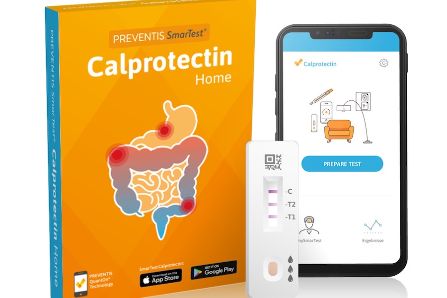 Home-testing option announced for IBD patients 