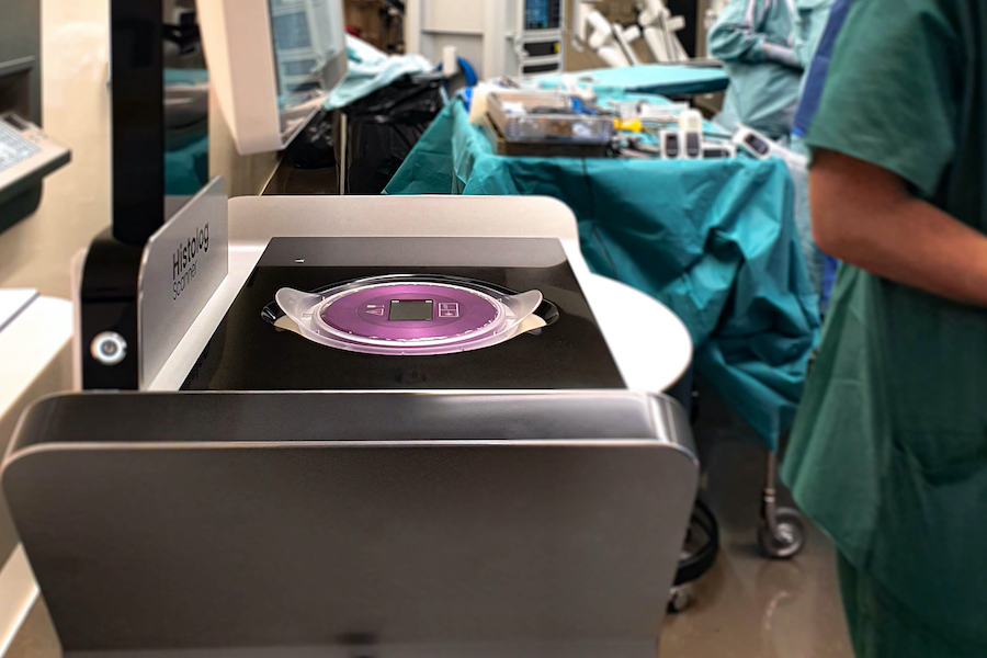 Leeds neurosurgeons to trial ultrafast scanner to accelerate treatment for brain tumours