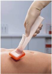 Reducing healthcare-acquired infection
