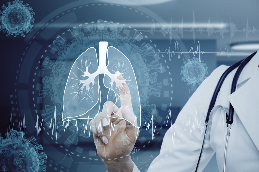AI project aimed at detecting early-stage lung cancer 