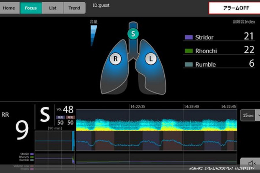 Novel device monitors breath sounds to predict respiratory failure in ICU patients after extubation