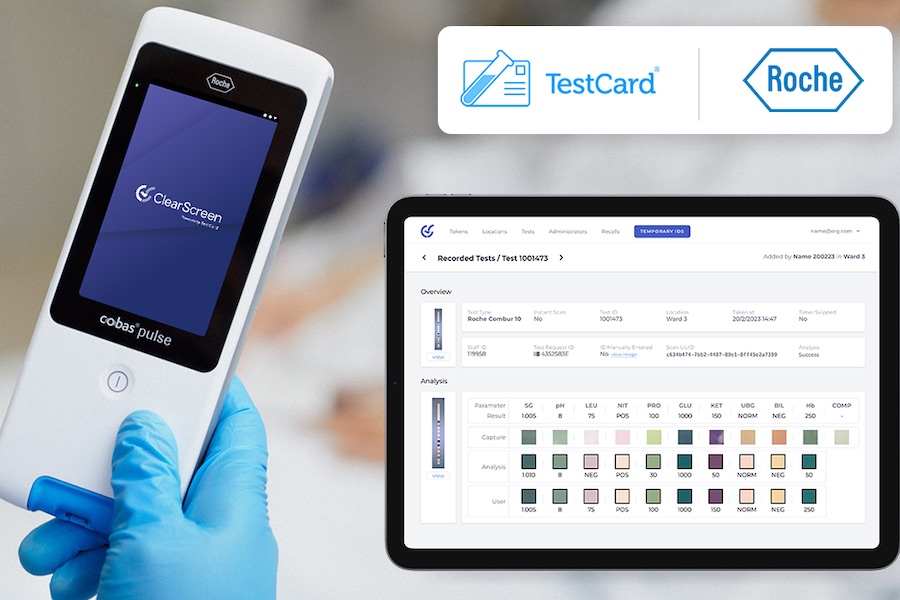 TestCard launches ClearScreen on Roche’s Navify marketplace 