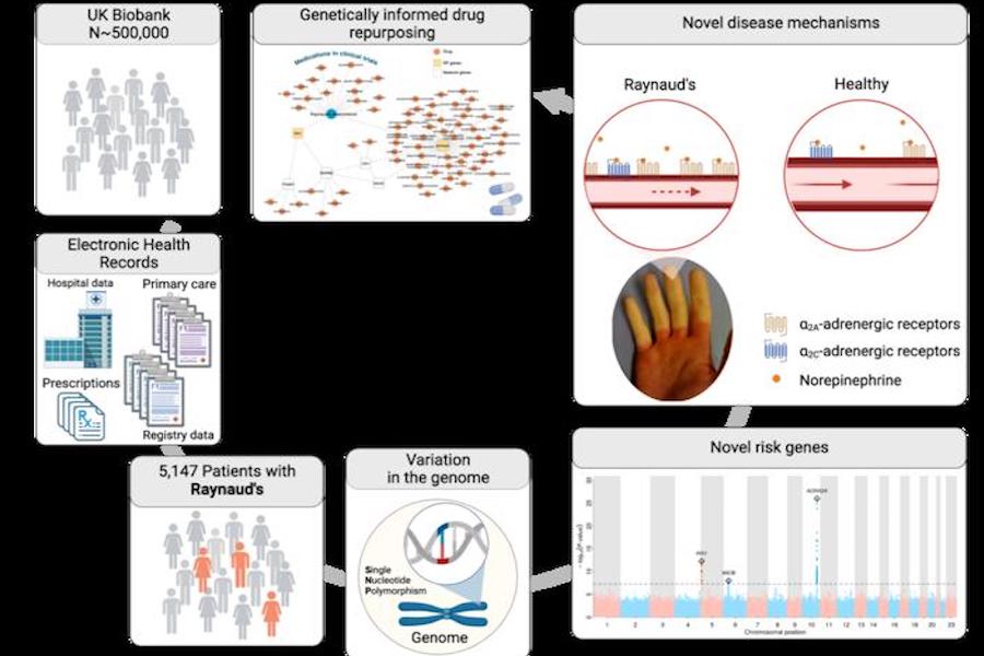 Researchers find genetic cause of Raynaud’s phenomenon