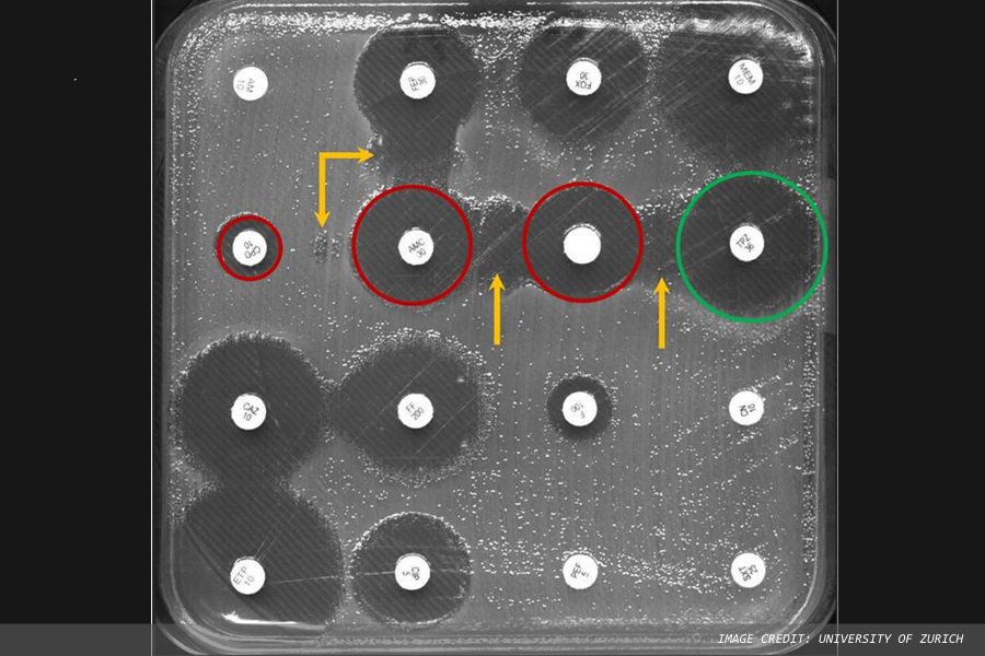 AI helps to detect antibiotic resistance