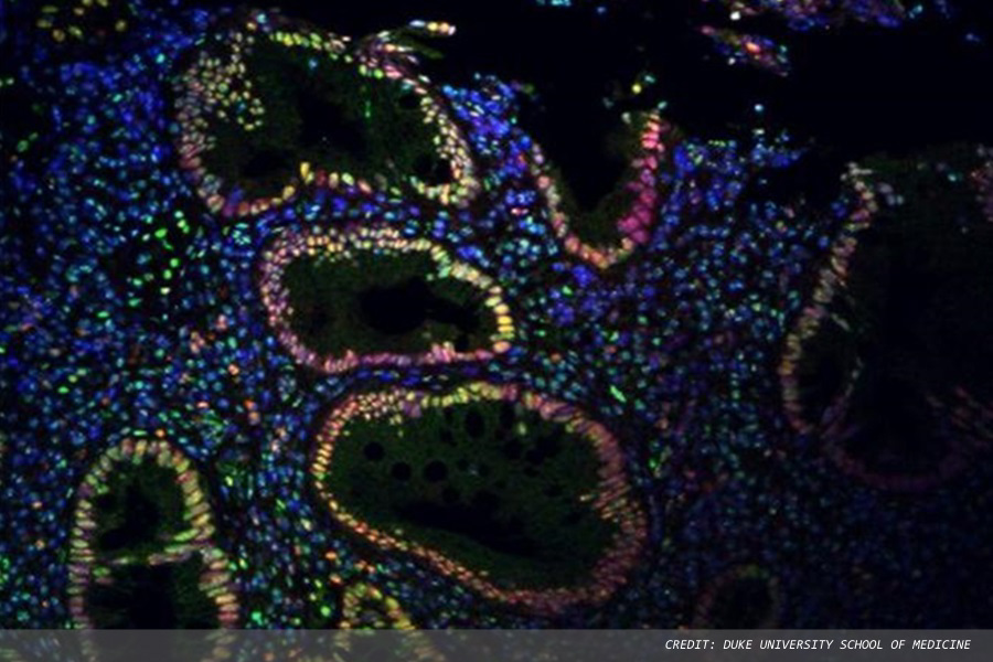 Nerve stimulation could ease inflammatory bowel disease