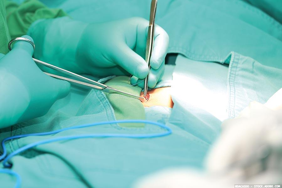 Johnson & Johnson MedTech joins experts to define and classify surgical site outcomes