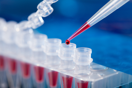 New blood test shows promising potential for early cancer detection