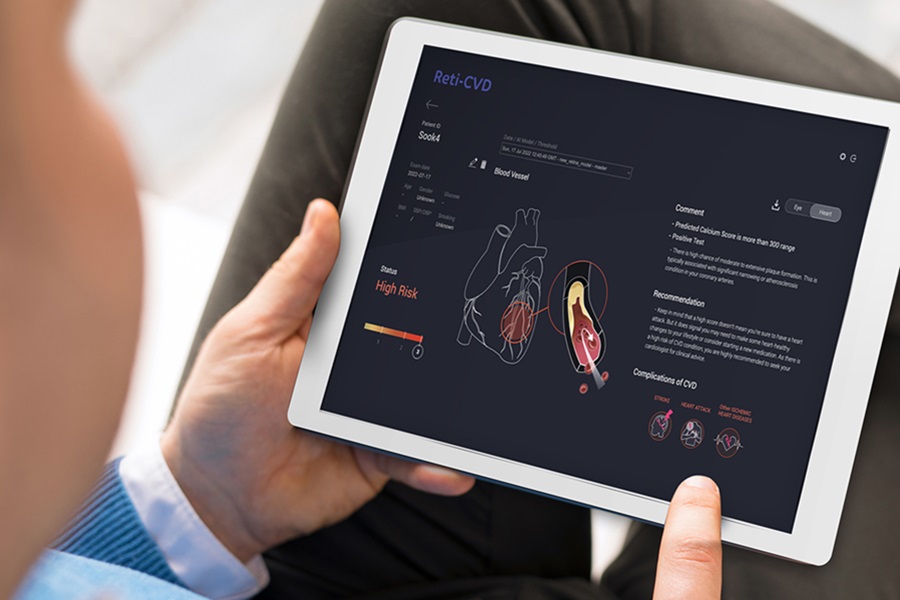 World’s first AI-powered cardiovascular retinal screening to be launched in the UK