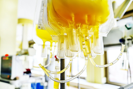 NHS patients receive first home-grown blood plasma treatments