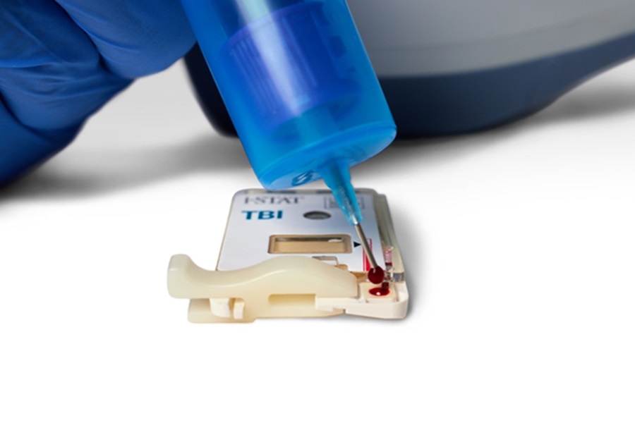 World-first portable whole blood rapid test for concussions launches in the UK