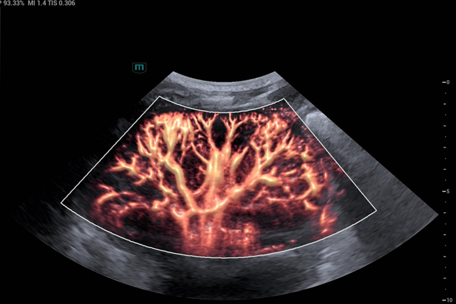 ‘A new era for ultrasound’: European healthcare professionals react to new ultrasound technology.